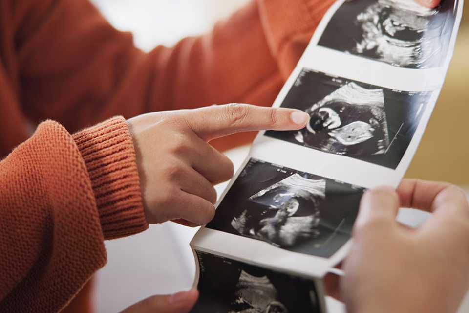 A couple holding their baby's ultrasound photos.